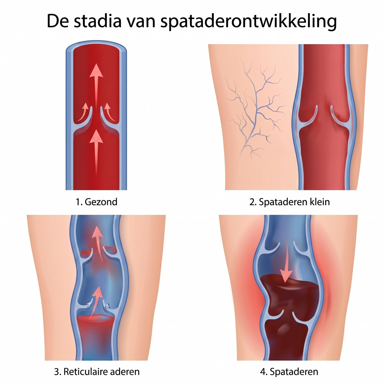 shutterstock_4stages